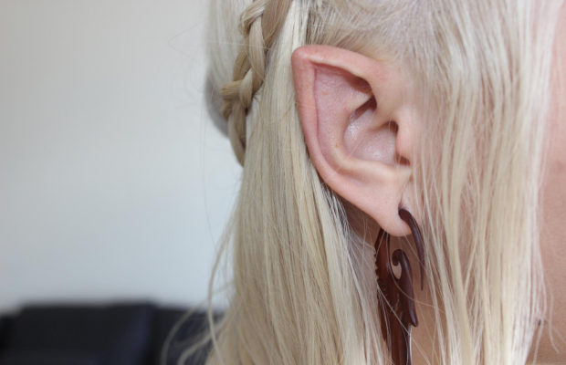 Reddit  cirugÃas estéticas