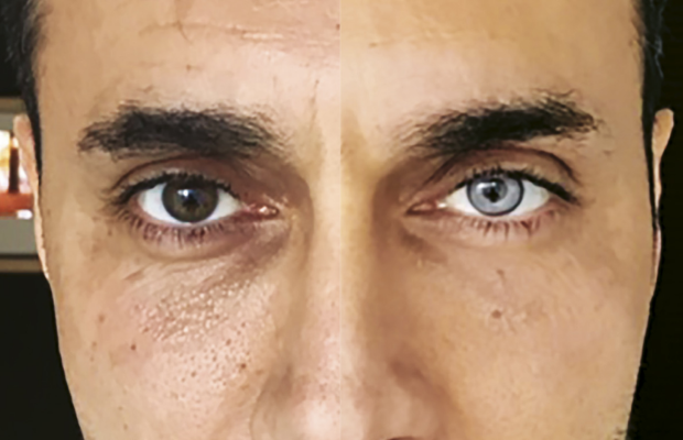 XLSemanal cirugÃas plásticas